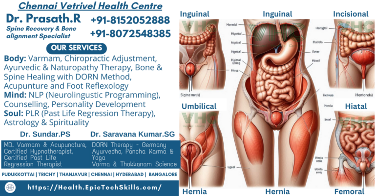 Image showing types of hernia with illustrations of the affected areas.