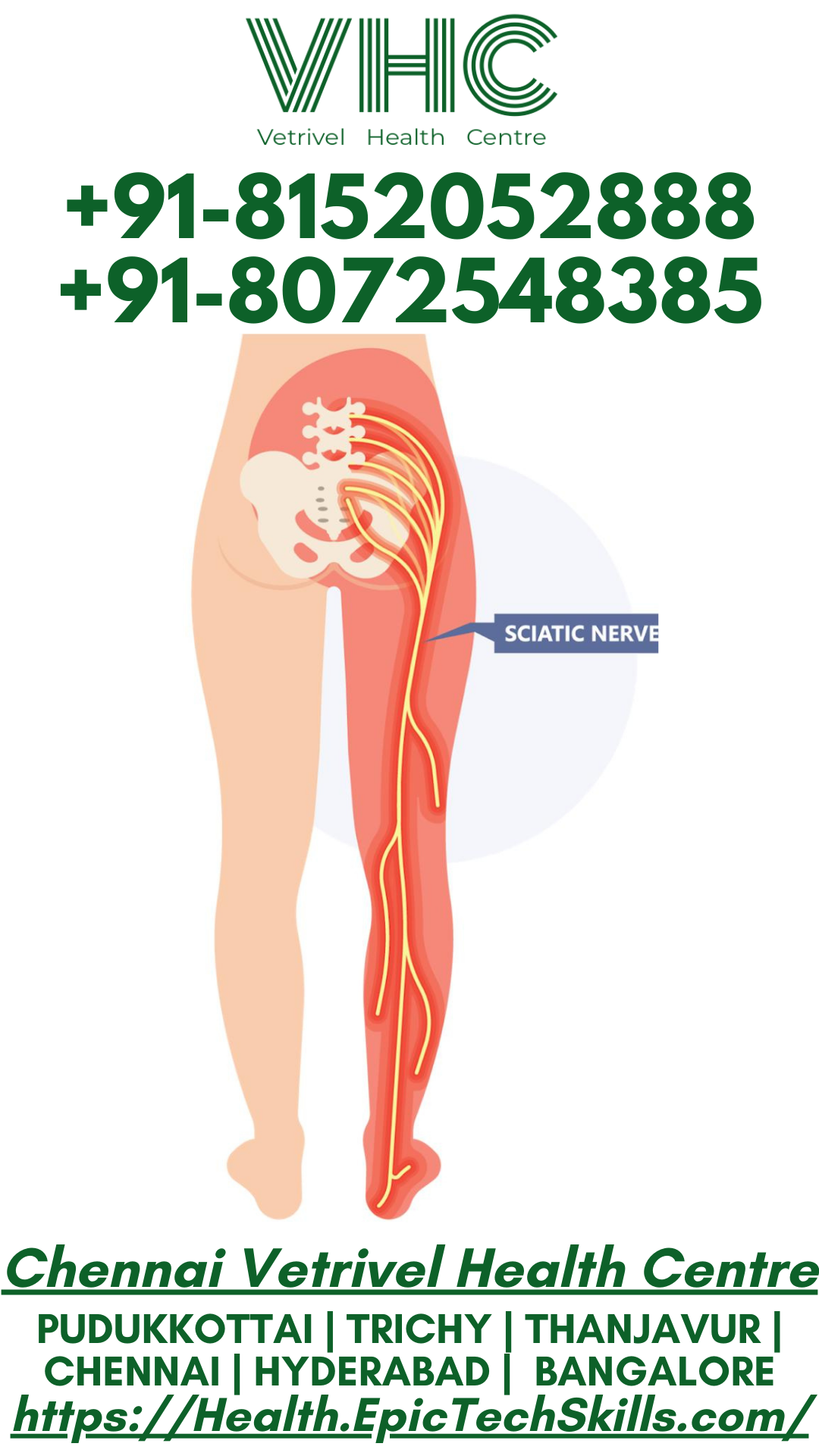 Sciatica nerve pain and its common symptoms, along with effective relief treatments.